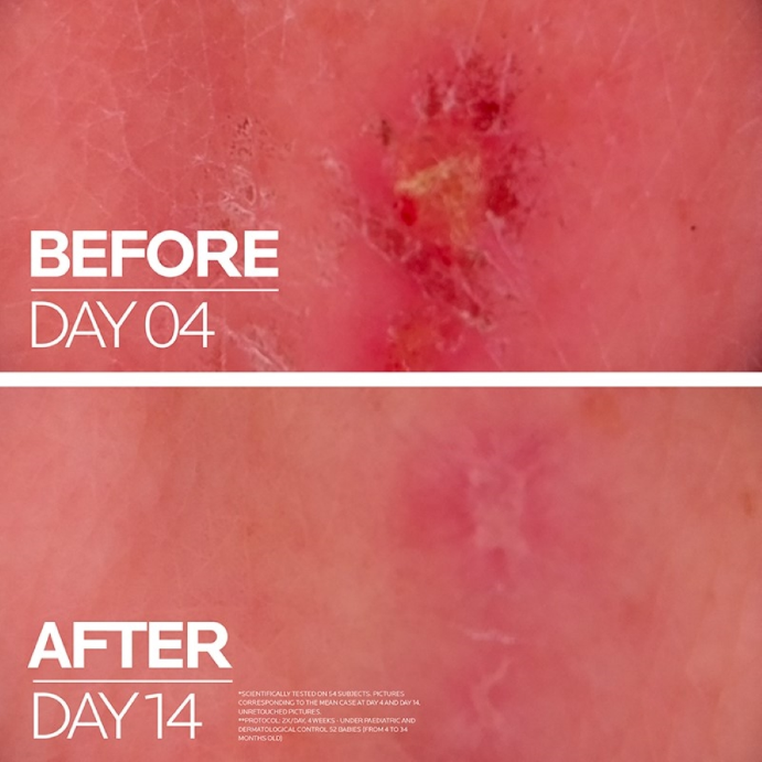 La Roche-Posay Cicaplast Baume B5+ 40mL