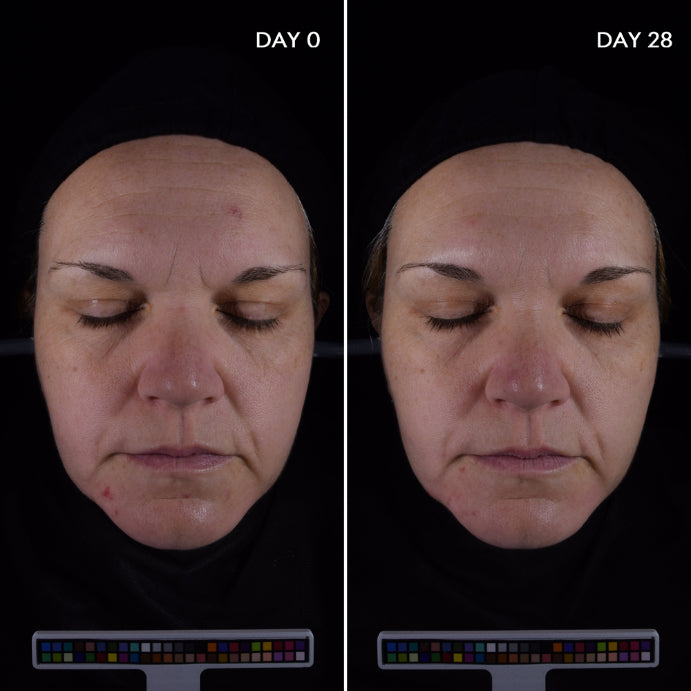 Bioderma Sebium Anti Imperfection Smoothing Concentrate Serum for Acne Prone Skin 30ml