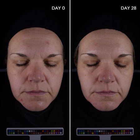 Bioderma Sebium Anti Imperfection Smoothing Concentrate Serum for Acne Prone Skin 30ml