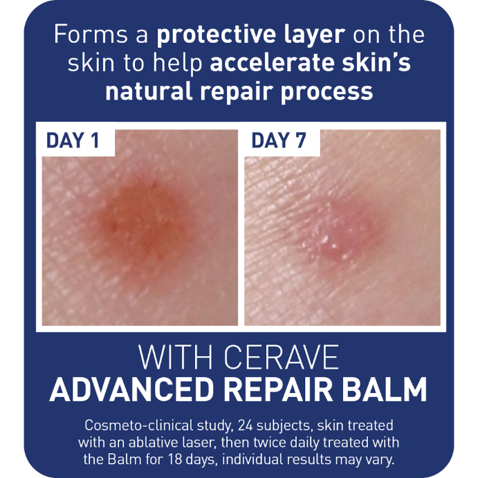 CeraVe Advanced Repair Balm 88mL