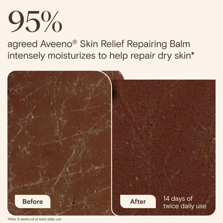 Aveeno Skin Relief Repairing Balm 75mL