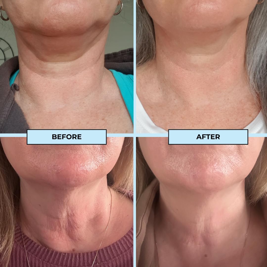 BOOST LAB Edelweiss Neck Firming Serum 30mL