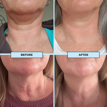 BOOST LAB Edelweiss Neck Firming Serum 30mL