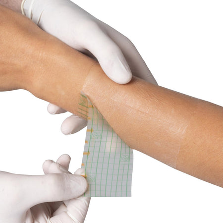 Medstock Film Dressing Roll 5 cmx1M