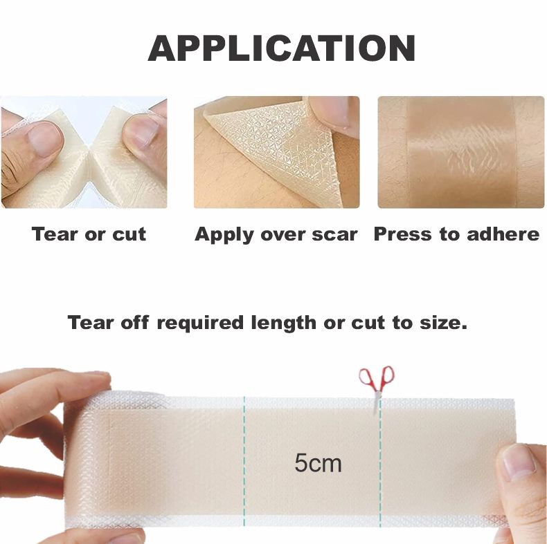 Bodyassist Silicone Scar Tape 4cm X 1.5m