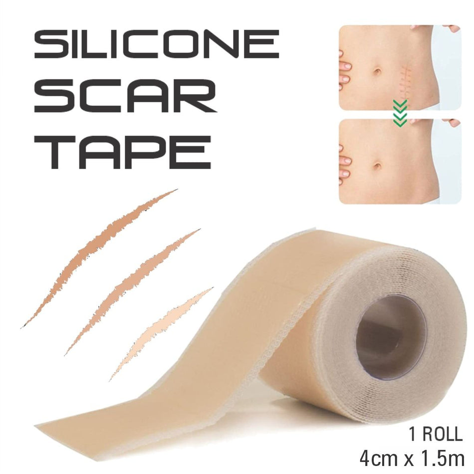Bodyassist Silicone Scar Tape 4cm X 1.5m