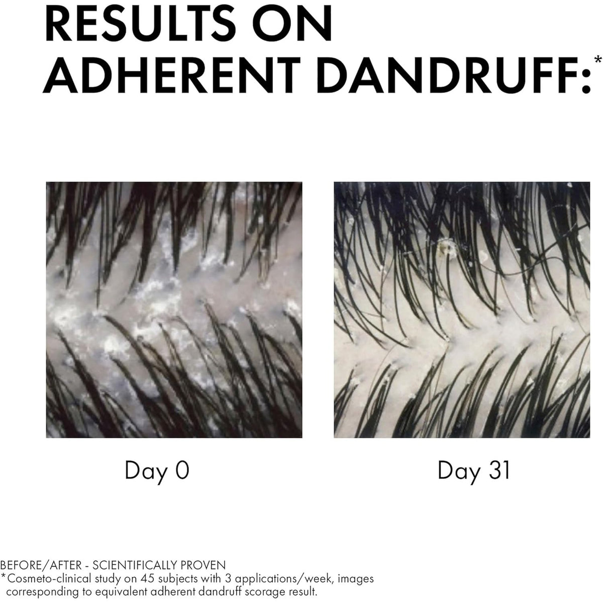 Dercos Anti-Dandruff DS Shampoo for Normal to Oily Hair 200ml