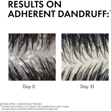 Dercos Anti-Dandruff DS Shampoo for Normal to Oily Hair 200ml