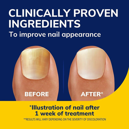 Scholl Nail Revitaliser Serum 10ml