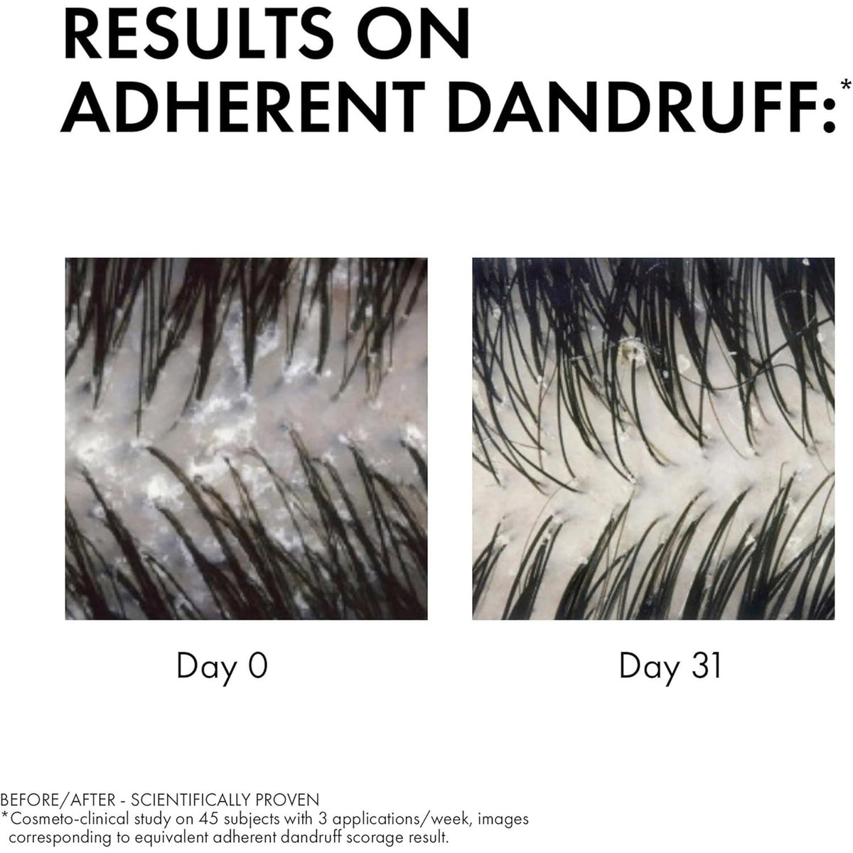 Dercos Anti-Dandruff Shampoo for Sensitive Scalp 200ml