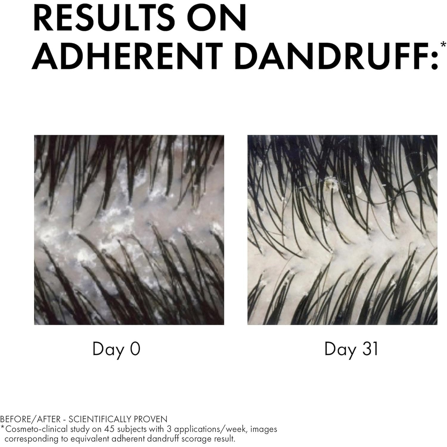 Dercos Anti-Dandruff Shampoo for Sensitive Scalp 200ml
