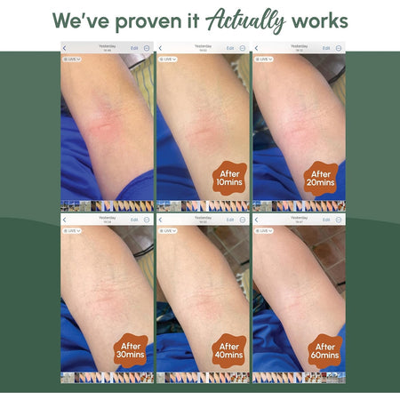 Good Riddance Rescue Balm 10g