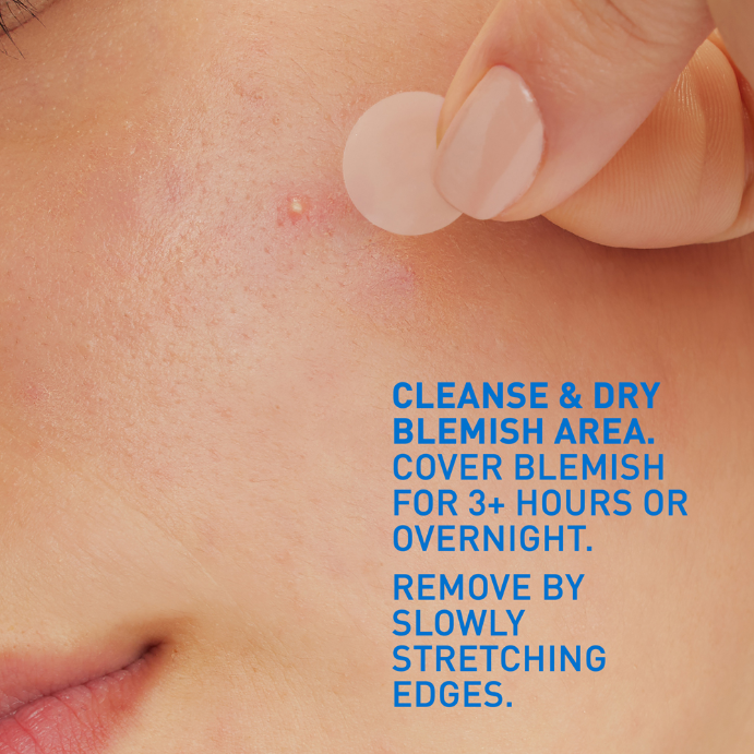 CeraVe Blemish Barrier Patches 22 Patches
