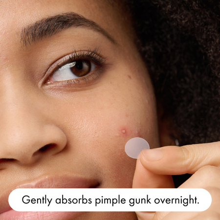 Hero Mighty Patch the Original Pimple Patches 24 Pack