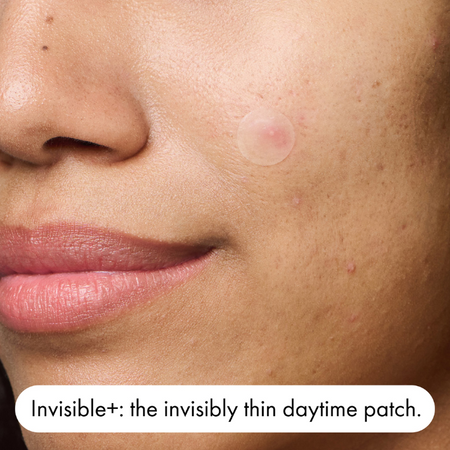 Hero Mighty Patch Duo Pimple Patches 12 Pack