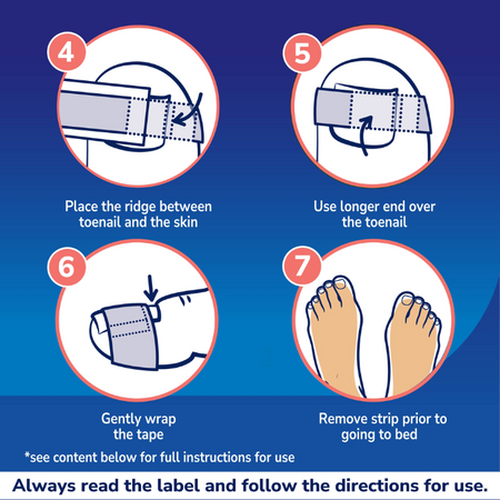 Scholl Ingrown Toenail Pain Relief Strips 6 Pack