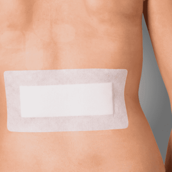 AEROFIX Non-Woven Island Dressing 9 x 20cm 20PK