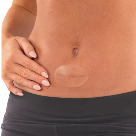 Aeroscar Silicone Scar Patch 7.4 X 4.4cm 10pk