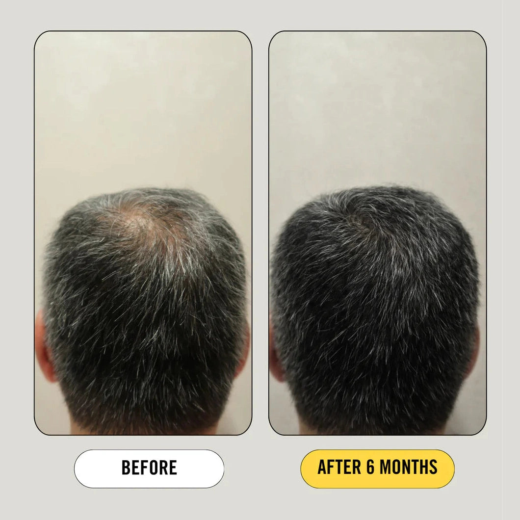 Growth Bomb Regrowth Assist Support for Thinning Hair Supplement 30 Capsules