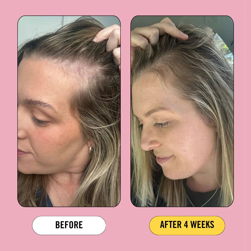 Growth Bomb Post Pregnancy Hair Strength Support 60 Tablets