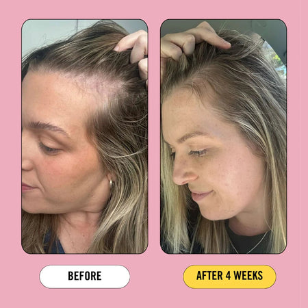 Growth Bomb Post Pregnancy Hair Strength Support 60 Tablets